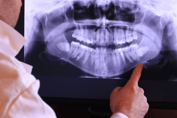 Best Emergency Cosmetic Dentistry in Beaverton, MI